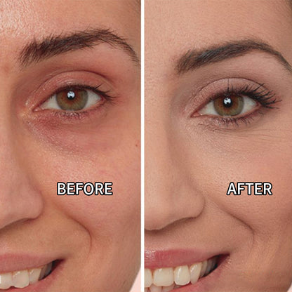 🔥 Colored Clay Under Eye Corrector - Full Coverage, Hydrating